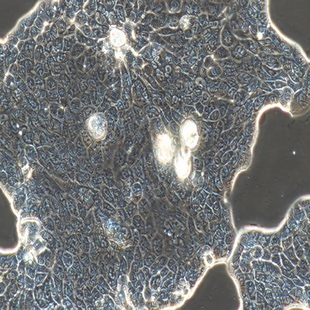 Human Lung Adenocarcinoma Cell Line, #CALU-3