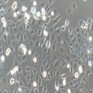Human Cervical Carcinoma Cell, #CASKI