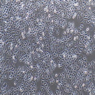 Human Cervical Carcinoma Cell, #CHANG LIVER
