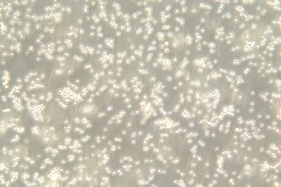 Human Burkitt'S Lymphoma Cell Line, #DAUDI