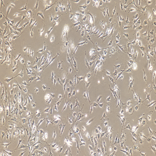 Human Umbilical Vein Cell Line Are Confluent Cell Line, #EA.HY926