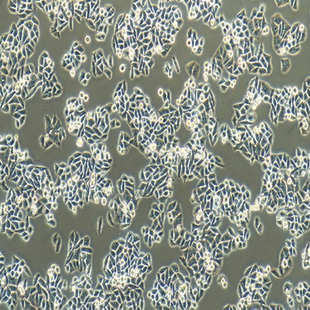 Human Esophageal Cancer Cell Line, #ECA-109