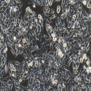 Human Gastric Mucosal Epithelial Cell Line, #GES-1