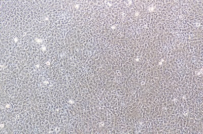 Mammary Epithelial Cell Line With A Human Integrated Sv40 Gene, #HBL-100