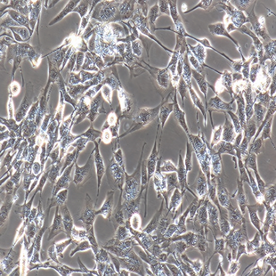 Immortalized Microvascular Endothelial Cell Line Of The Human Brain, #HCMEC/D3
