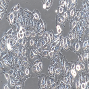 Human Cervical Cancer Cell Line, #HELA