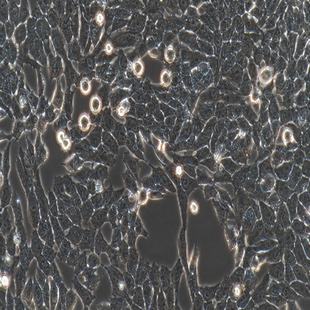 Human Gastric Carcinoma Cell, #HGC-27
