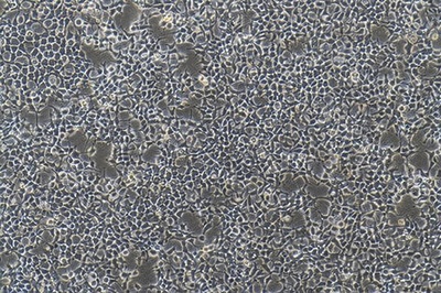 Human Renal Epithelial Cell Line, #HKB-20