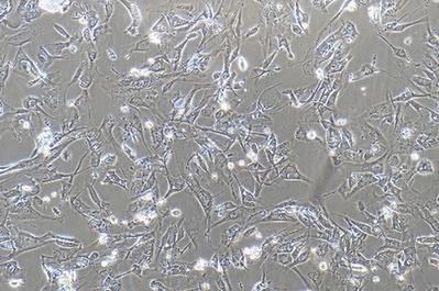 Human Pancreatic Ductal Cell Line, #HPNE