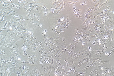 Human Breast Cancer Cell, #HS578T