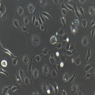 Human Umbilical Vein Endothelial Cell Line (Immortalized) , #HUVEC