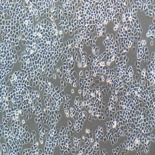 Human Normal Ovarian Epithelial Cell Line, #IOSE-80