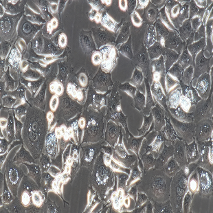 Human Esophageal Cancer Cell Line, #KYSE-30