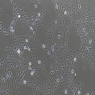 Human Hepatic Astrocytes, #LX-2