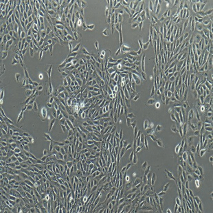 Human Mammary Gland Epithelial Cell Line, #MCF-10A
