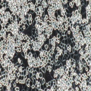 Human Breast Cancer Cell, #MDA-KB2