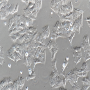 Human Breast Cancer Cell, #MDA-MB-361