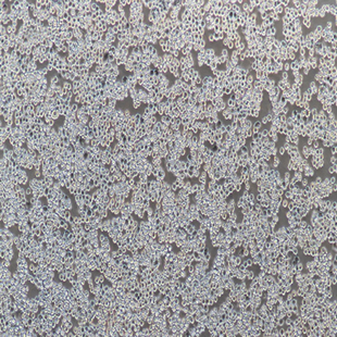 Human Breast Cancer Cell, #MDA-MB-453