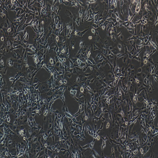 Human Membrane Mesothelial Cell Line, #MET-5A