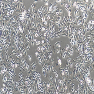 Human Gastric Carcinoma Cell, #MGC-803