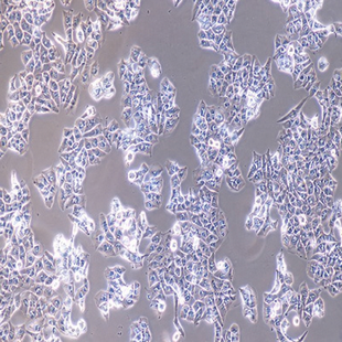Human Highly Metastatic HCC Cell Line, #MHCC-97L