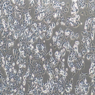 Human Highly Metastatic HCC Cell Line, #MHCC-97H