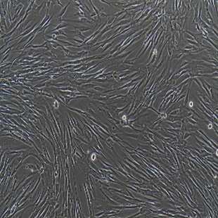 Human Embryonic Lung Cell Line, #MRC-5