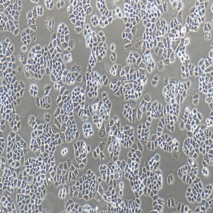 Human Cell Lung Cancer Cell Line, #NCI-H460 [H460]