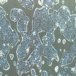 Human Gastric Carcinoma Cell, #NCI-N87