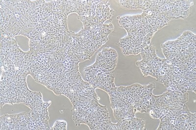 Migratory Cell Papilloma Of The Human Bladder, #RT4