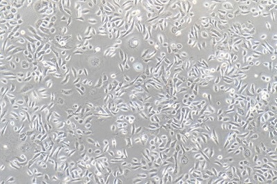 Normal Cell Line Of The Human Prostate Gland, #RWPE-2