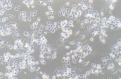 Human Breast Cancer Cell, #SK-BR-3