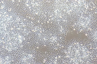 Human Neuroepithelioma Cell Line, #SK-N-MC