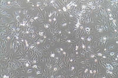 Immortalized Cell Line Of The Human Ureteric Epithelium, #SV-HUC-1