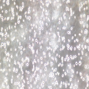 Human Lymphoblastoid Cell Line, #T2 (174XCEM.T2 )