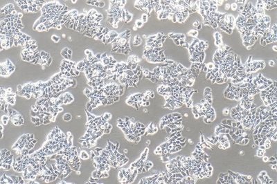 Human Breast Ductal Cancer Cell Line, #T47D