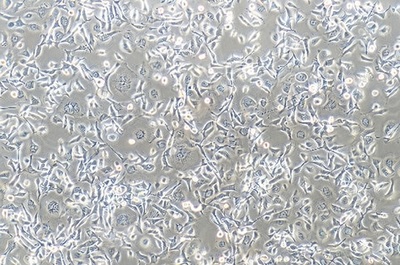 Human Esophageal Cancer Cell Line, #TE-1