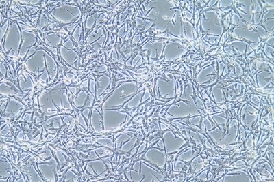 Astroglilastoma Of The Human Brain, #U87MG