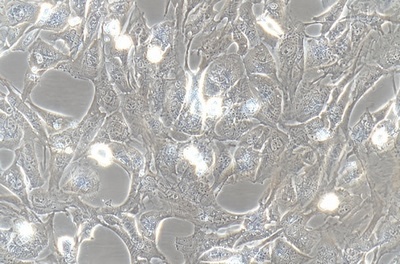 Immortalized Cell Line Of The Human Normal Prostate Stroma, #WPMY-1