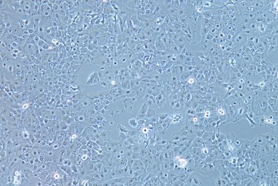Human Oesophageal Squamous Carcinoma Cell Line, #KYSE-150