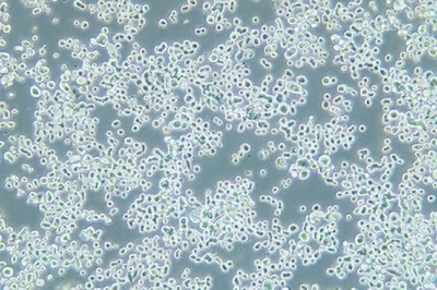 Human Gastric Carcinoma Cell, #KATO III