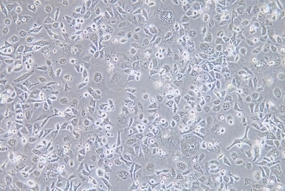 Human Cervical Epidermal Carcinoma Cell Line, #ME-180
