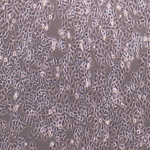Human Highly Metastatic Hcc Cell Line, #HCC-LM3