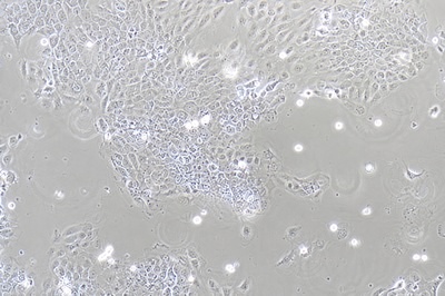 Human Bladder-Squamous Carcinoma Cell Line, #SCABER