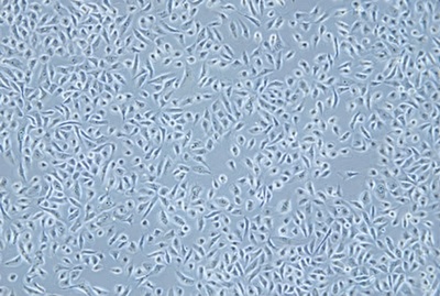 Normal Cell Line Of The Human Prostate Gland, #RWPE-1