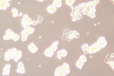 Human Breast Cancer Cell, #ZR-75-1
