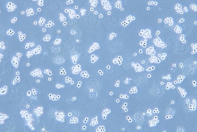 Human Gastric Carcinoma Cell, #SNU-1