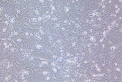 Human Esophageal Cancer Cell Line, #TE-12