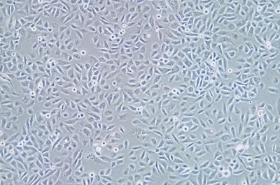 Human Bronchial Epithelial Cell Line, #HBE135-E6E7