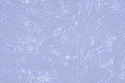 Human Normal Colonic Epithelial Cell Line (Limited Cell Line) , #CCD841 CON